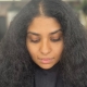 Signs your nanoplasty was done wrong