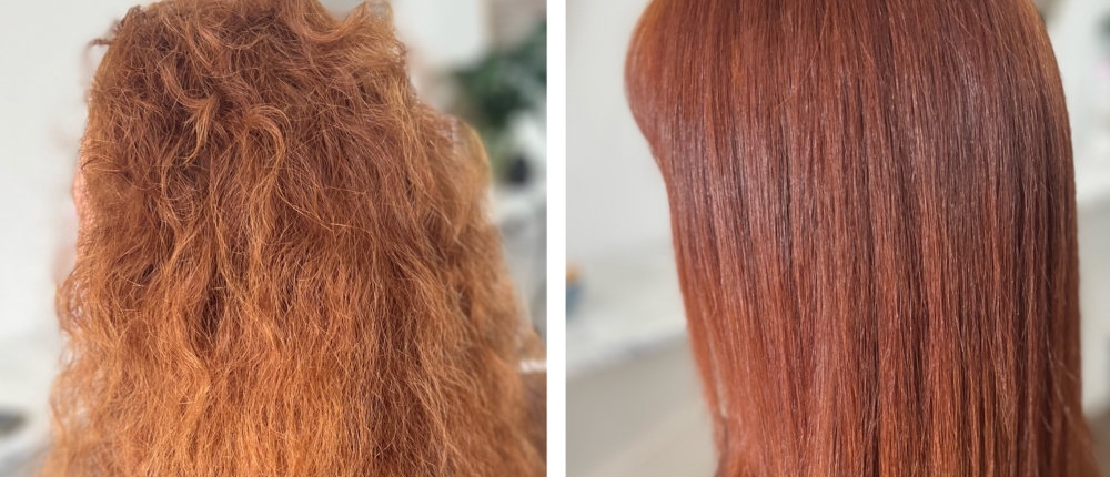 Will nanoplasty affect my hair colour