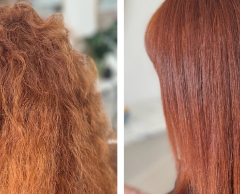 Will nanoplasty affect my hair colour